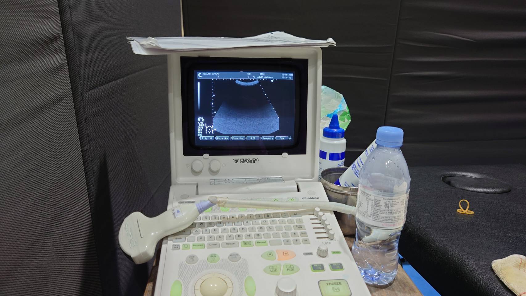 超音波篩檢設備。